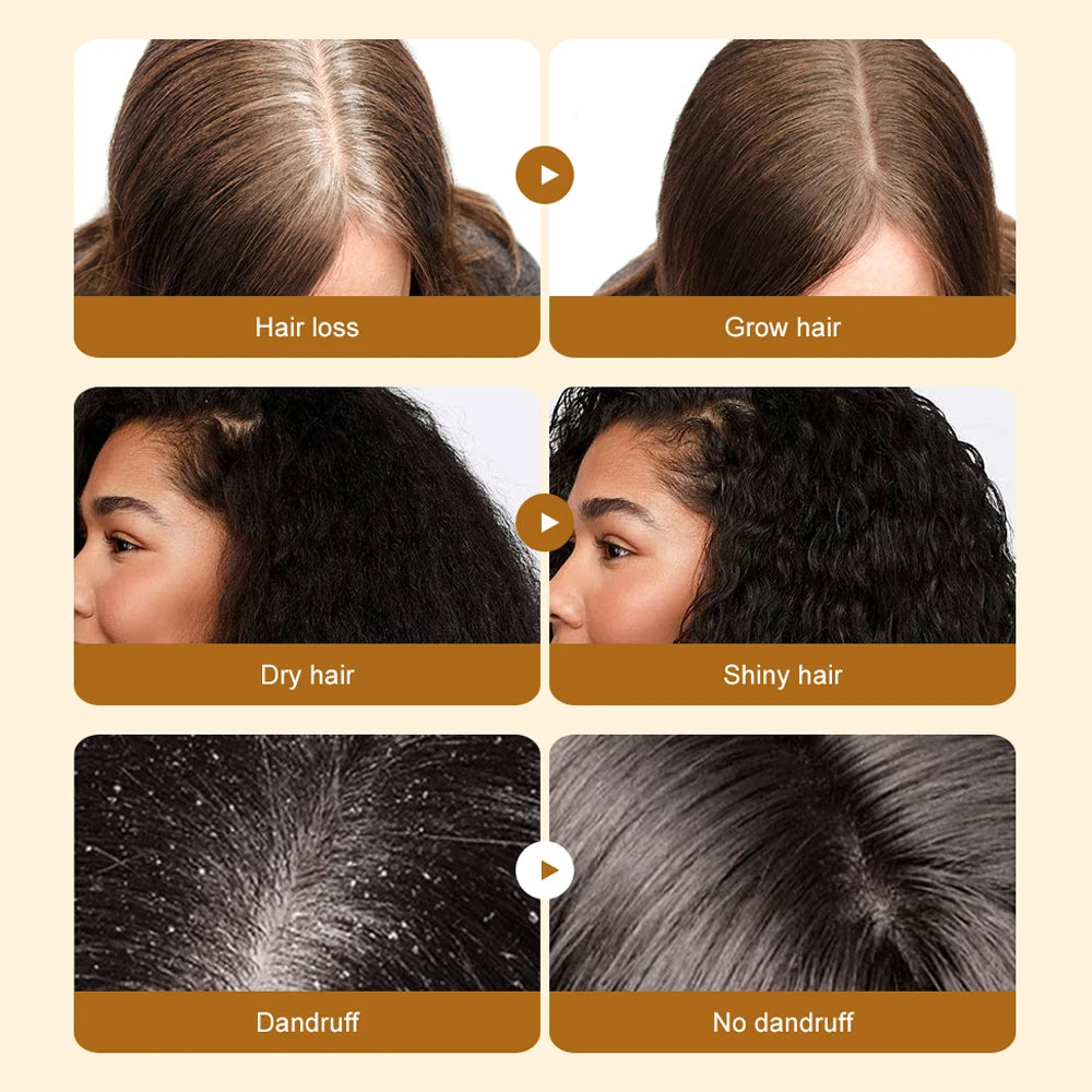 100% Pure Batana Oil Hair Conditioner Natural Hair Treatment Oil for Treating Hair Loss Anti-Breakage Hair